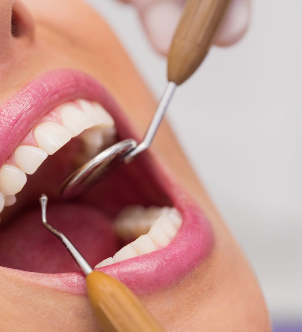dentist-examining-female-patient-teeth-scaled